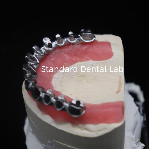 Полная арка Мало мост зубная реставрация циркониевые короны с резинкой Поэцелианская Китайская стоматологическая лаборатория