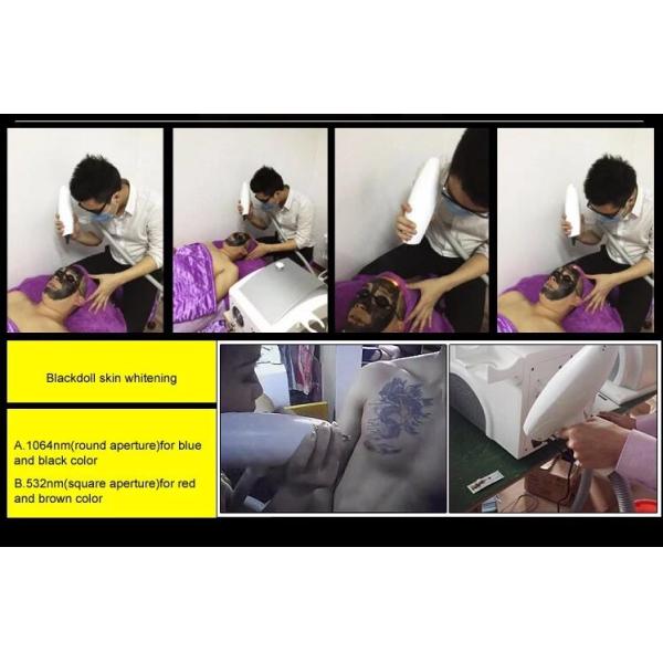 Nd Yag Laser Tattoo Removal Machine Multi Functional CE FDA ISO Certificated