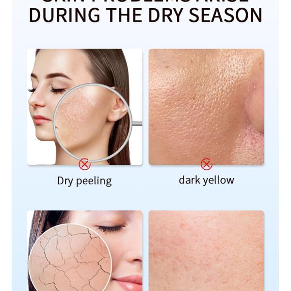 Loción Corporal Blanqueadora para el Cuidado de la Piel, Elimina Manchas Oscuras y Amarillentas