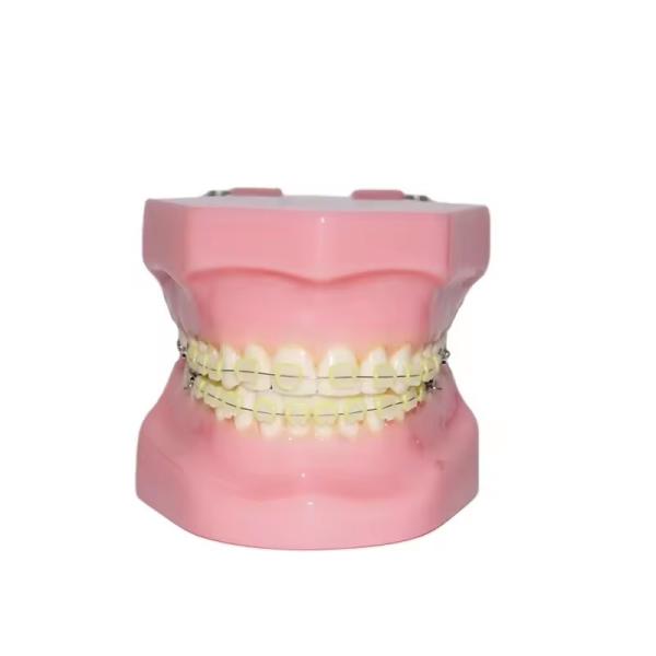Dental Typedont Dentes Modelo Para Preparação Dental Estudante Ortodontia Prática Modelo