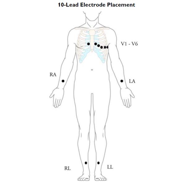 Сумка аллигаторных зажимов AAMI REF 989803129231 AAMI 10 1/8