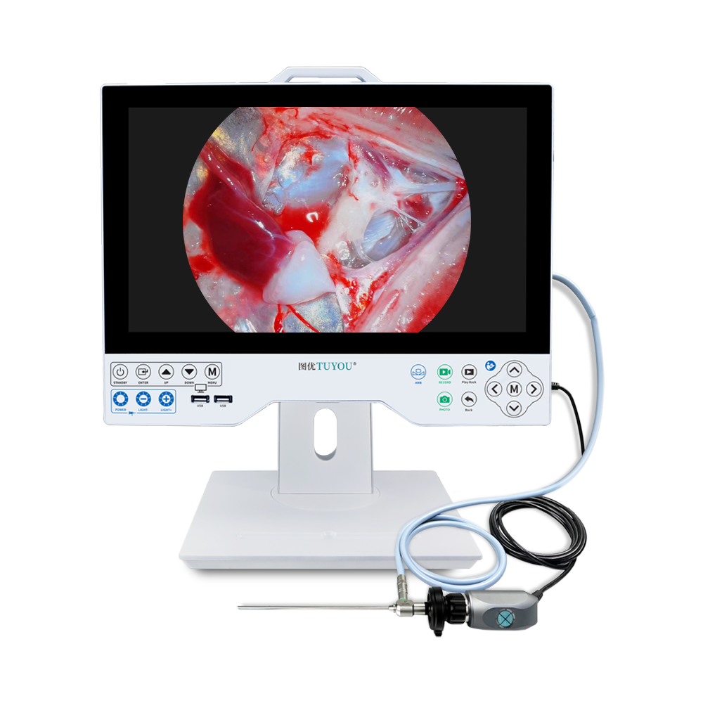 Premium 15.6'' Integrated Medical Endoscopy Camera With Light Source Ideal For ENT Minimally Invasive Surgery