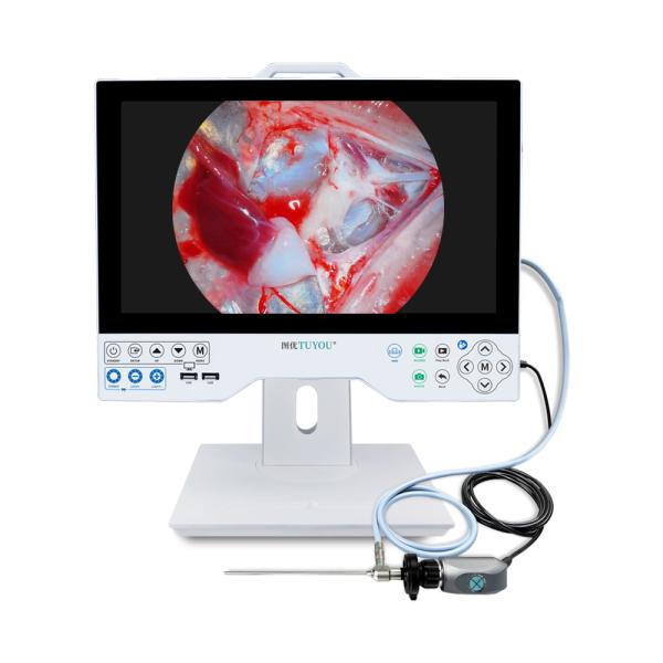 Premium 15.6'' Integrated Medical Endoscopy Camera With Light Source Ideal For ENT Minimally Invasive Surgery