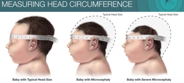 Fita de medição da circunferência meados de plástica do úmero para a clínica pediatra