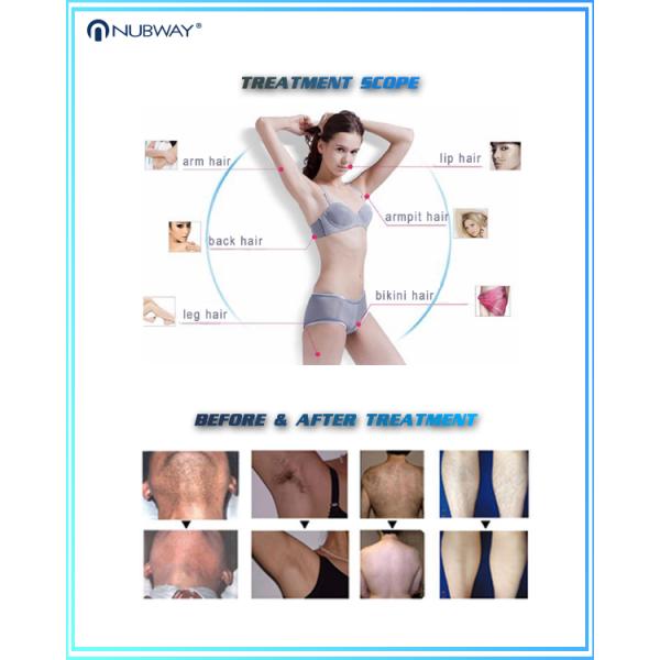 Hot sale Diode laser hair removal machine/ permanent and painfree