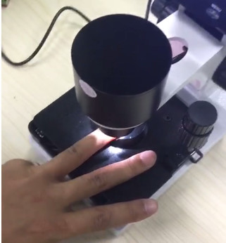 Микроскоп микроциркуляции следующего поколени, микроскоп кровеносного сосуда для