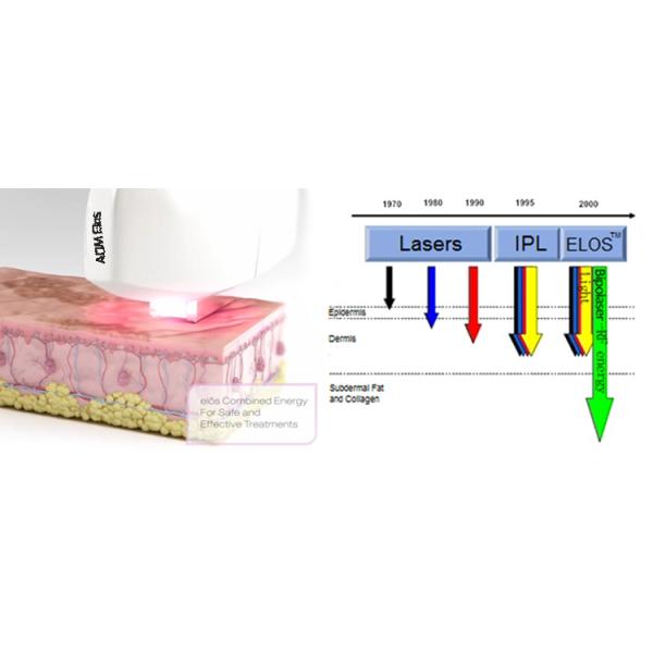 Skin Rejuvenation IPL Intense Pulsed Light Laser With 7 Ipl Filters Vertical Beauty Machine