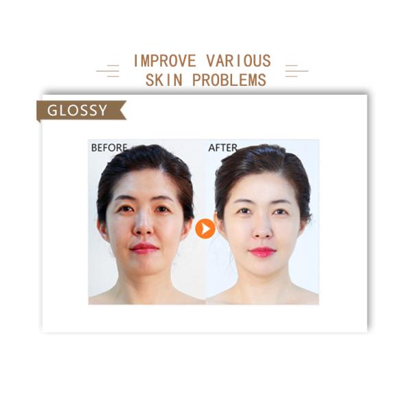 Máquina de belleza facial Cuidado de la piel portátil Uso en el hogar Esencia Masaje facial Estiramiento de la piel Refuerzo de la piel