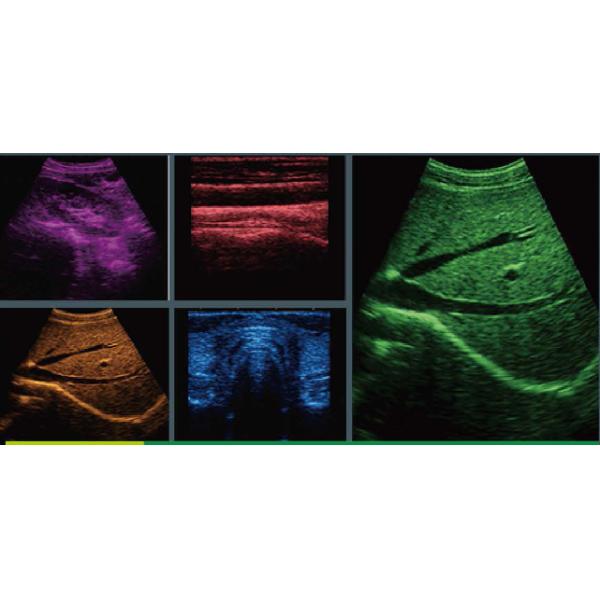 High Elements Trolley Full Digital Veterinary Ultrasound Disagnostic System