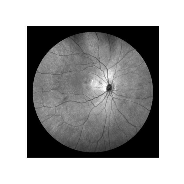 Equipo oftálmico de Angiograph Digital 160° de la retina