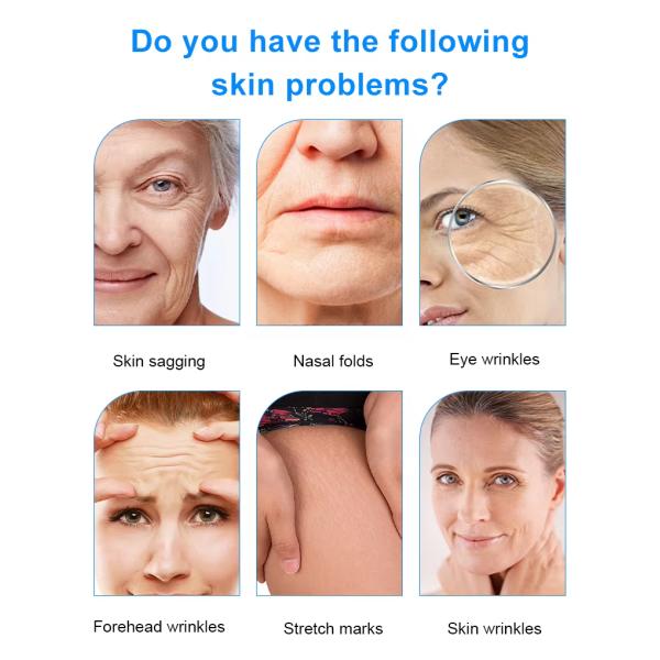 Rejuvenecimiento de la piel Eliminación de arrugas Rostro de la piel del rostro 12D Hifu máquina