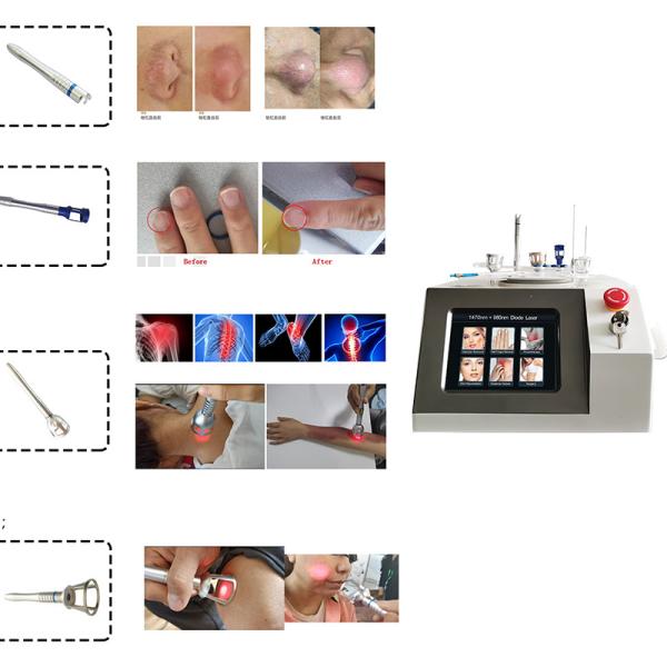 2024 Newest Endolaser 1470nm 980nm Diode Laser Face Lifting Liposuction Machine