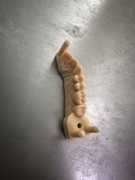 Jaw Model 3D Dental Model Printing Bite Pads Dental Bonding Resin Bonding Teeth Near Me