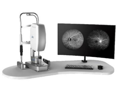 Equipamento oftálmico de Angiograph Digital 160° da retina