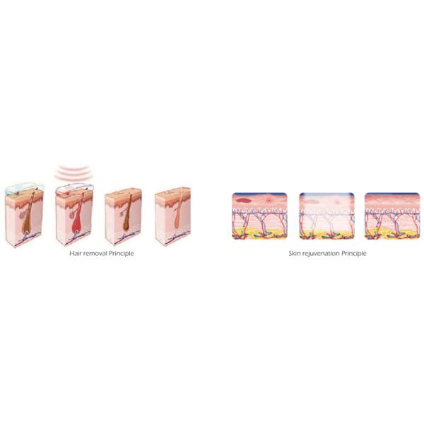 Painfree Hair Removal Skin Rejuvenation IPL Laser Equipment IPL SHR Machine