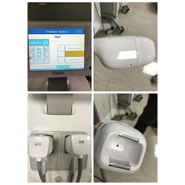 Liposonix ultrashape HIFU уменьшая AC 100-240V оборудования потери веса, 50/60 Hz