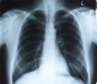 Imagem latente médica seca do laser X Ray para AGFA 5300/5302/5500, 35cm x 43cm