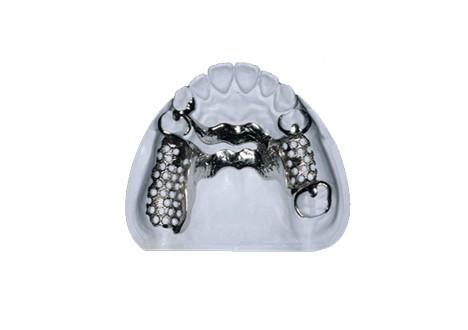 Easy To Clean Metal Frame Partial Denture Comfortable For Long Lasting Use