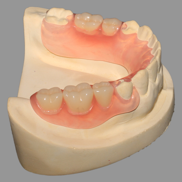 Dental Lab Crown | Casting Pink TCS Flexible Partials With Excellent Retention