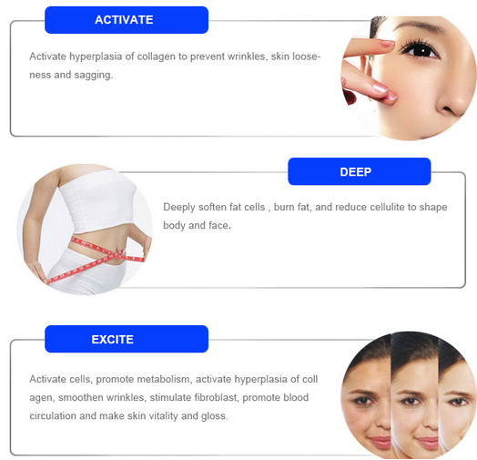 laser hair removal diode laser hair removal machine price