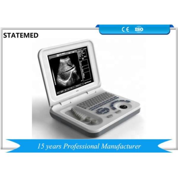 Medical Pregnancy Test Mobile Ultrasound Machine With Convex Probe Standard
