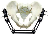 Tipo externo ortopédico quirúrgico de Fixator T para las fracturas pélvicas