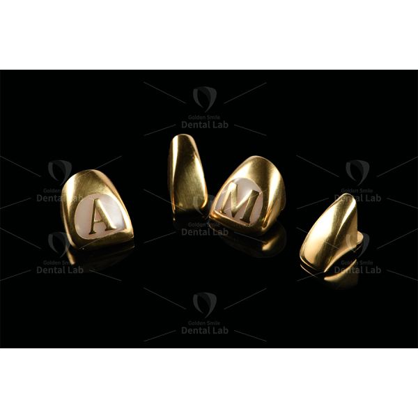 Yellow Gold 62% Full Cast Crown Saliva And Acids Resistant Gold Crown Implant