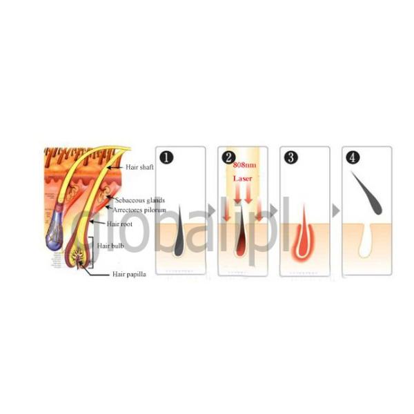 808nm Permanent Laser Hair Removal Machines / Hair Removal Equipment For All Types Skin