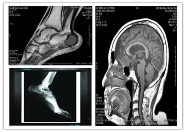 Filme seco baixo azul médico da imagem latente de Digitas varredura compatível de 8 x de 10in Hosipital Mri