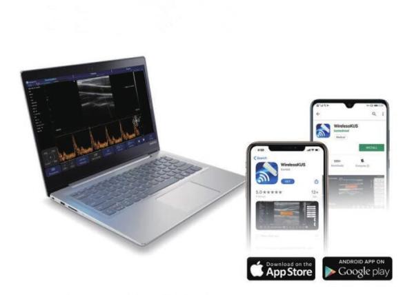 Ultrasonic Transducer Linear Convex Probe Handheld Ultrasound Scanner Wifi Connection Support Printing Reports