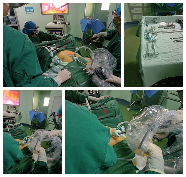 Endopass 12mm устранимое Laparoscopic оптически Trocar видимое Trocar