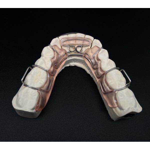 Comfortable Stainless Steel Acrylic Hawley Retainer Effective Orthodontic Solution