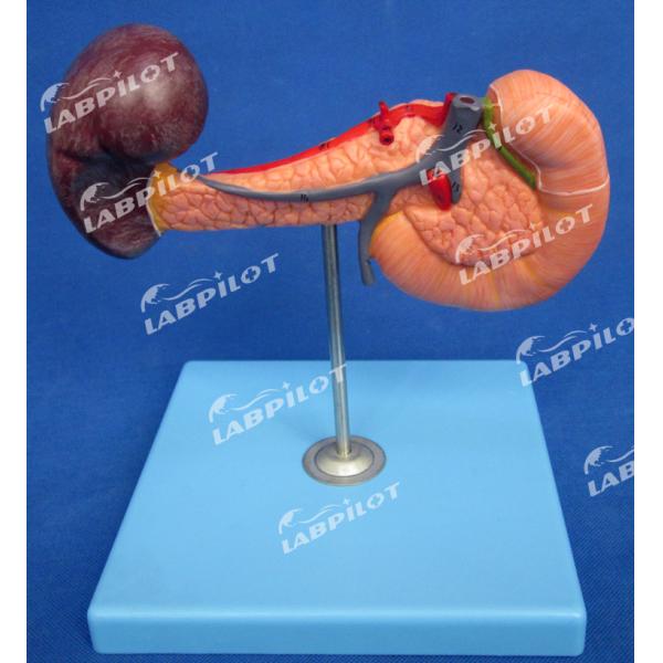 Educational Demonstration Model of Human Life Size Pancreas with Spleen and Duodenum