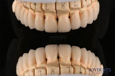 Polished Layered Dental Zirconia 0.3-0.5mm Thickness With CAD CAM Technology