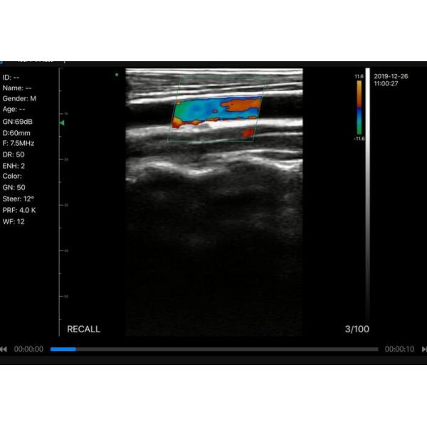 Блок развертки ультразвука ультразвука кармана ручной с b, B/M, цветом Doppler, PW, элементами режима 128 Doppler силы