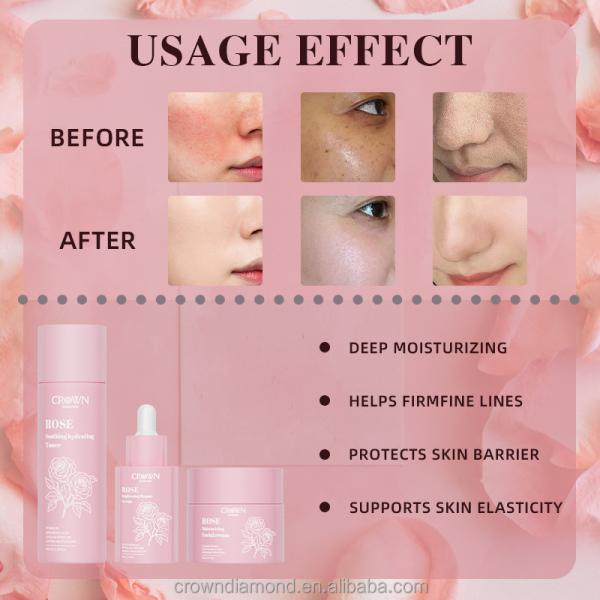 Marque privée Niacinamide éclaircissant anti-âge Rides Crème Rétinol sérum Rose Toner Ensemble de soin de la peau du visage