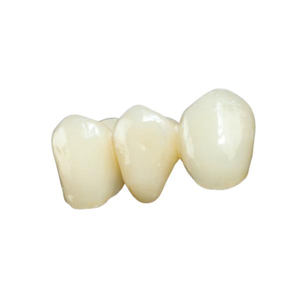 Лаборатория зубного имплантата Biocompatibility высокого моста стабильности съемного зубоврачебного высокая