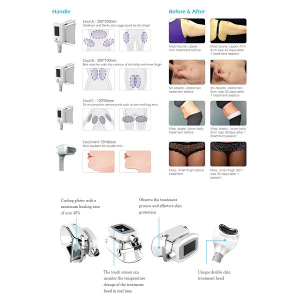 Professional Slimming Machine Cryolipolysis Coolsculptor Machine For Fat Weight Reduction 2-6 Handles for Option
