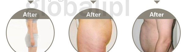 CE Approved RF frequency Focused Vacuum Slimming Machine with ultrasound waves