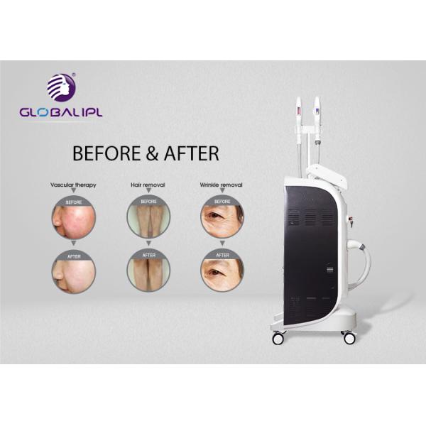 690nm Painless E Light 4000W OPT Shr Laser Machine