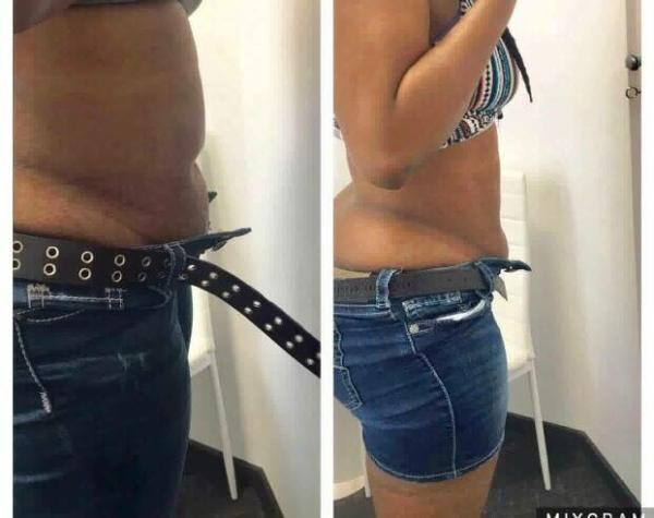 wind+water+semiconductor cooling system cryotherapy slimming machine 4-5cm fat lost after 1 treatment