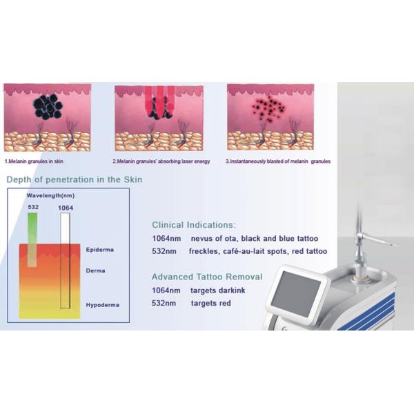 Picosecond Laser 1064nm 532nm Pico Q Switched Nd Yag Laser for Tattoo Removal Machine