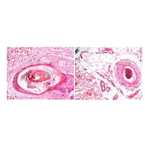 Ipl Rf Hair Removal / Skin Treatment Equipment With 10.4 Inch LCD Display Screen