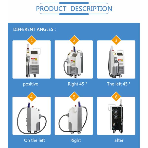 Portable 755nm Pigment Removal Q Switched Nd Yag Laser Tattoo Removal Machine with CE