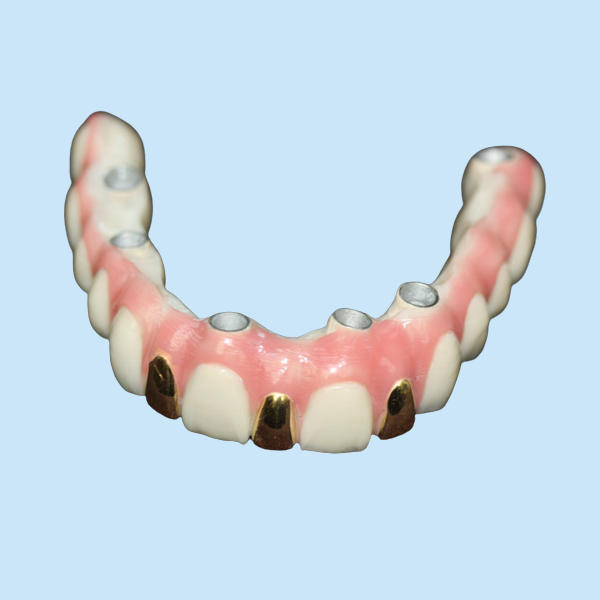 Точность цифров 3D печатая основанный металл Адвокатуры зубного имплантата