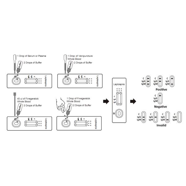 Анализ крови инфекции золота коллоидный обнаруживает КЭ освобоженный антителом Марк Лептосприа