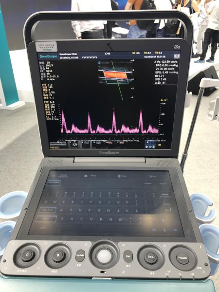 Portable 3D 4D Color Doppler USG&Sonoscape S9