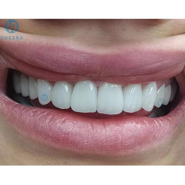 Печь 1700 Zirconia Dg Макс зубоврачебная спекая для зубоврачебной лаборатории