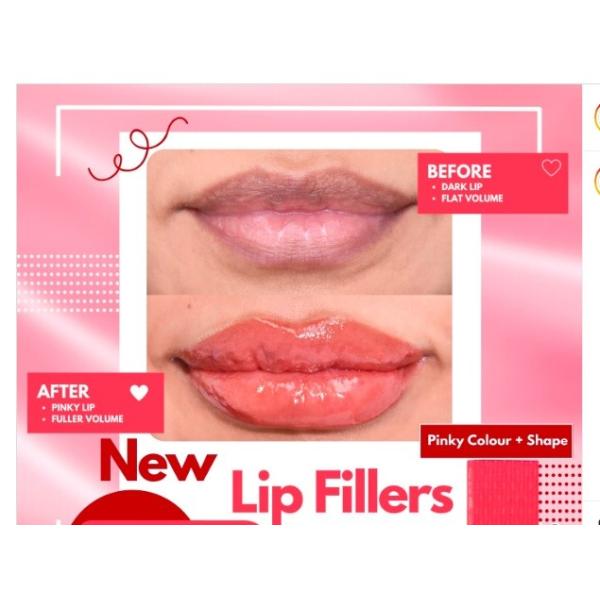 Experimenta el sexo perfecto con HYDROIAM beso aumento de labio RED LIP gel de ácido hialurónico con B12