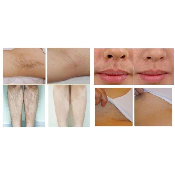 810nm Diode Laser Hair Removal Machine , 600W Alexandrite Laser Hair Depilation Machine